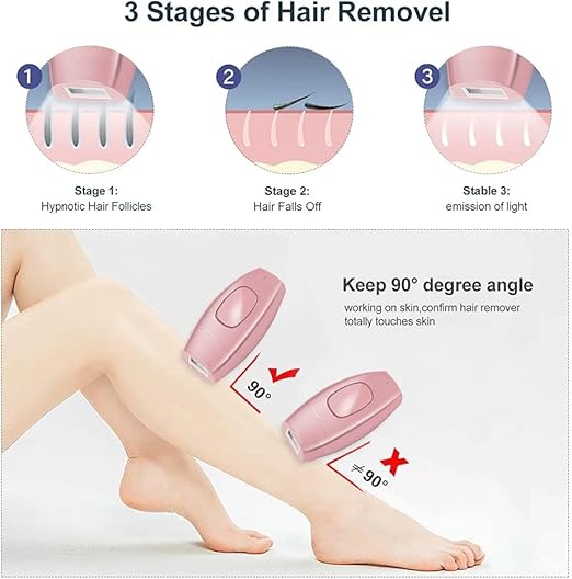 Mini Laser Hair Removal Device Painless & Permanent Hair Reduction